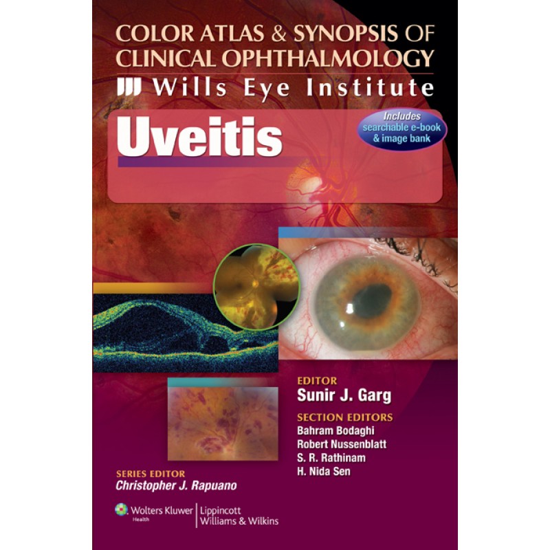 Wills Eye Institute - Uveitis