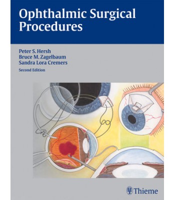 Ophthalmic Surgical Procedures