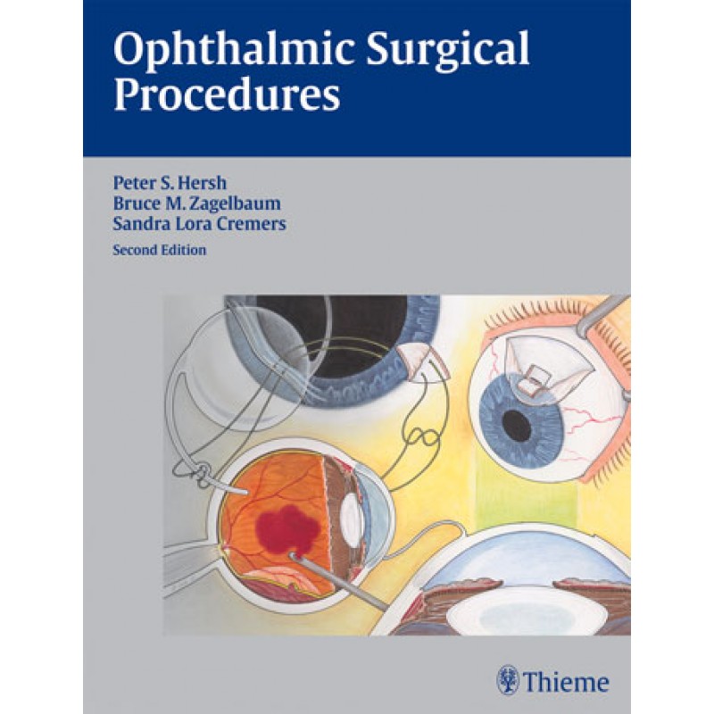 Ophthalmic Surgical Procedures