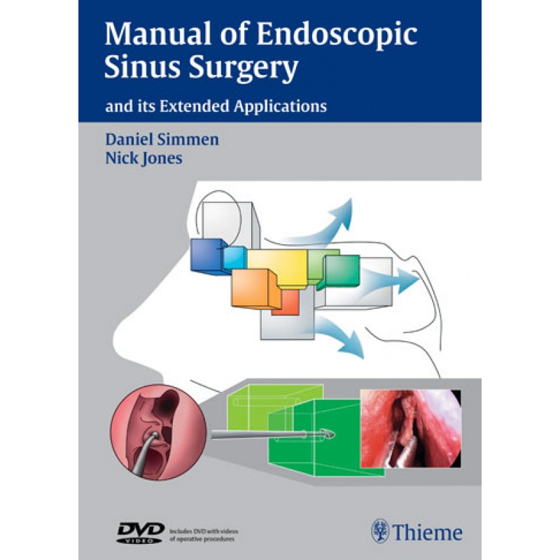 Manual of Endoscopic Sinus Surgery