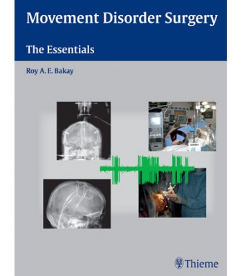 Movement Disorder Surgery