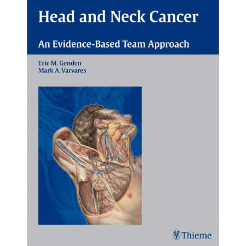 Head and Neck Cancer