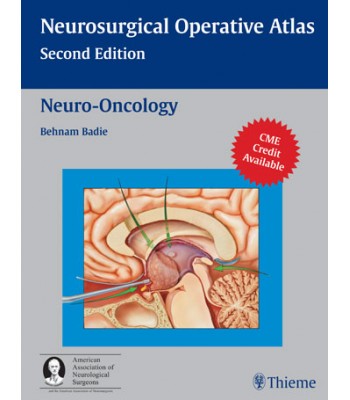 Neuro-Oncology