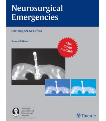 Neurosurgical Emergencies