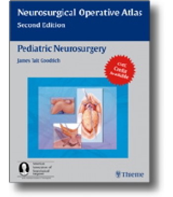 Pediatric Neurosurgery