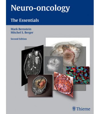 Neuro-oncology: The Essentials