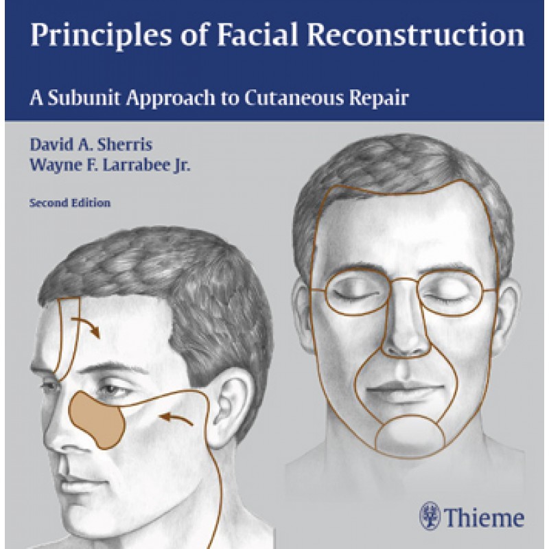 Principles of Facial Reconstruction