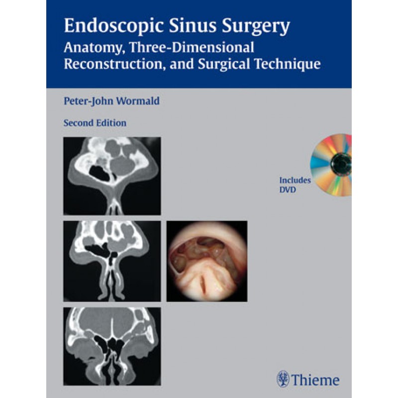 Endoscopic Sinus Surgery