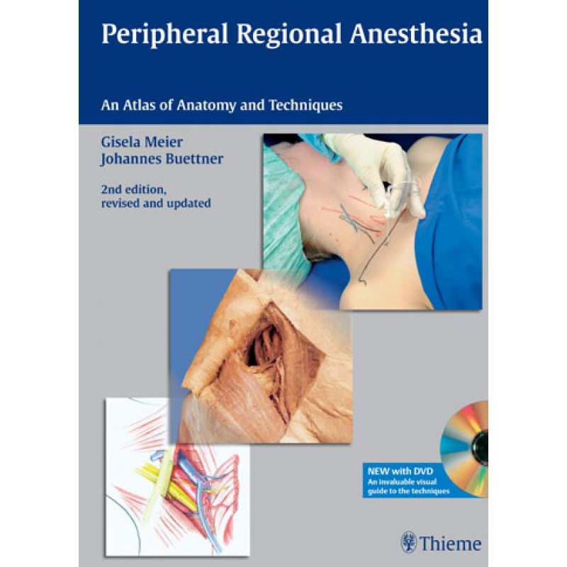 Peripheral Regional Anesthesia, Book with DVD