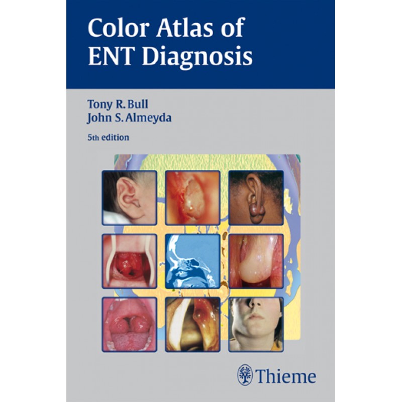Color Atlas of ENT Diagnosis