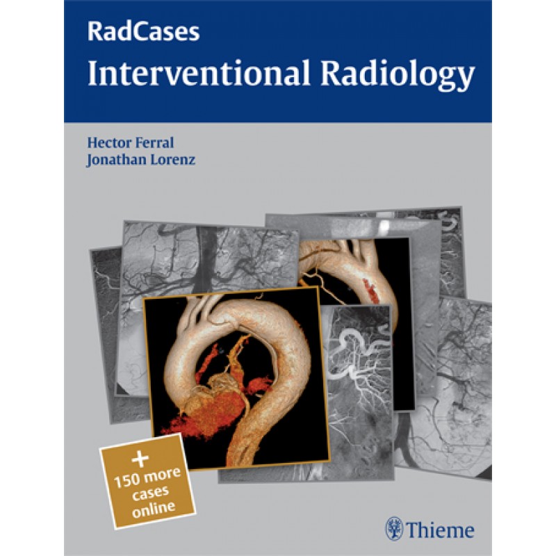 Interventional Radiology