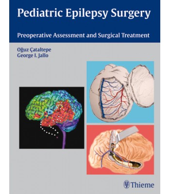 Pediatric Epilepsy Surgery Preoperative Assessment and Surgical Treatment