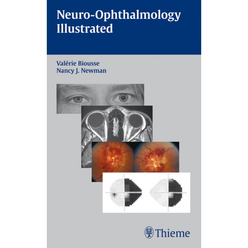 Neuro-Ophthalmology Illustrated