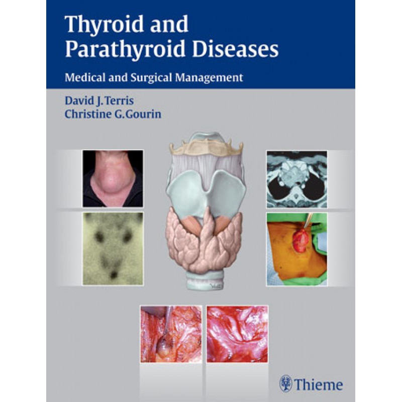 Thyroid and Parathyroid Diseases
