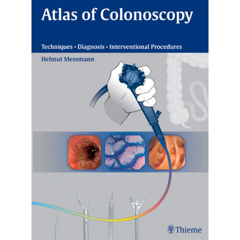 Atlas of Colonoscopy