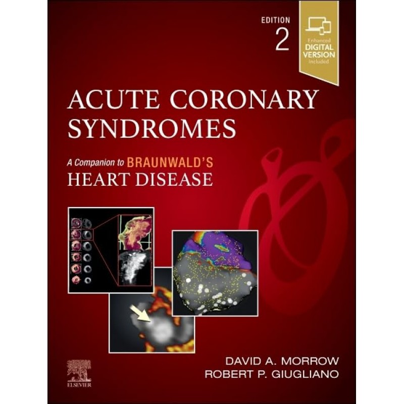 Acute Coronary Syndromes, 2nd Edition