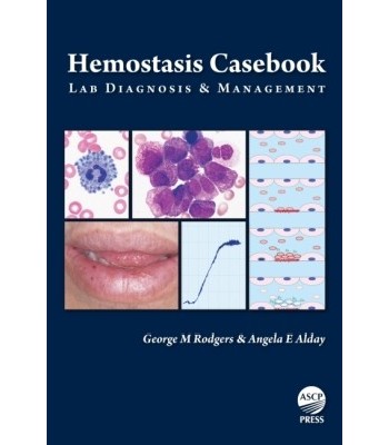 Hemostasis Casebook