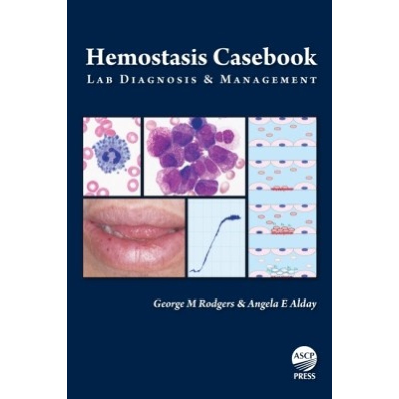 Hemostasis Casebook