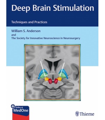  Deep Brain Stimulation Techniques and Practices
