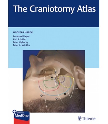 The Craniotomy Atlas