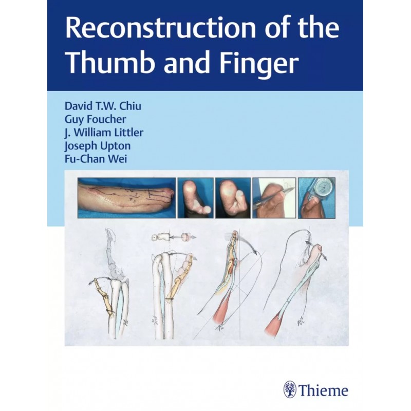 Reconstruction of the Thumb and Finger 