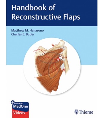 Handbook of Reconstructive Flaps 