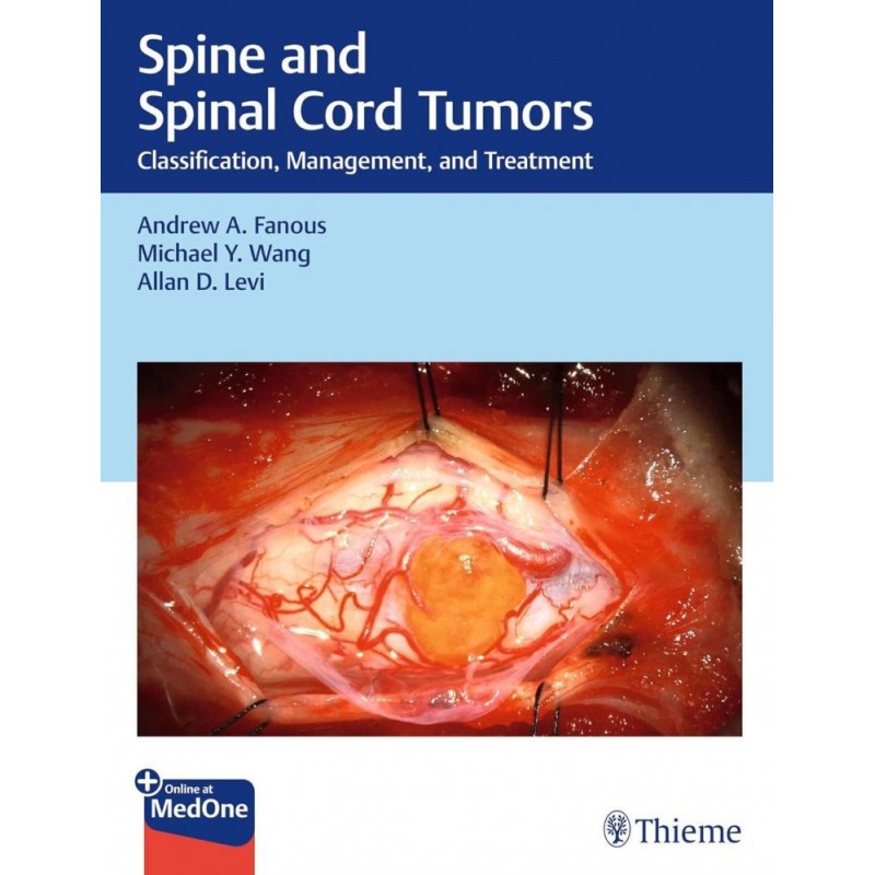 Spine and Spinal Cord Tumors. Classification, Management, and Treatment