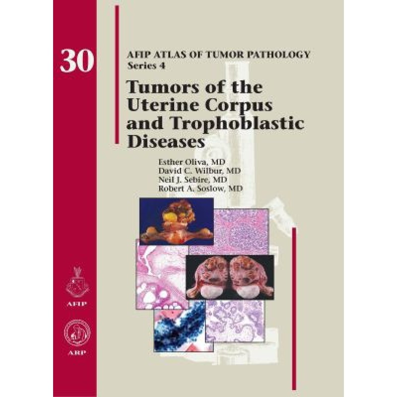 Tumors of the Uterine Corpus and Gestational Trophoblastic Diseases