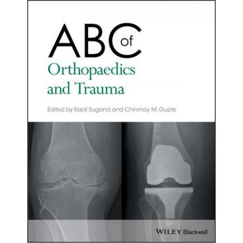 ABC of Orthopaedics and Trauma
