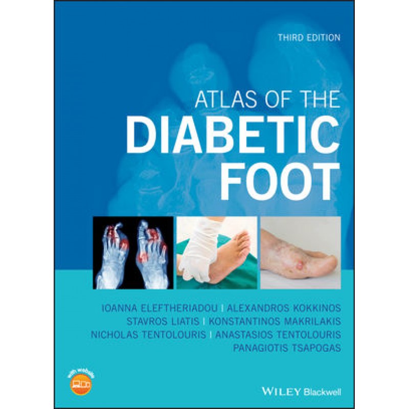 Atlas of the Diabetic Foot, 3rd Edition