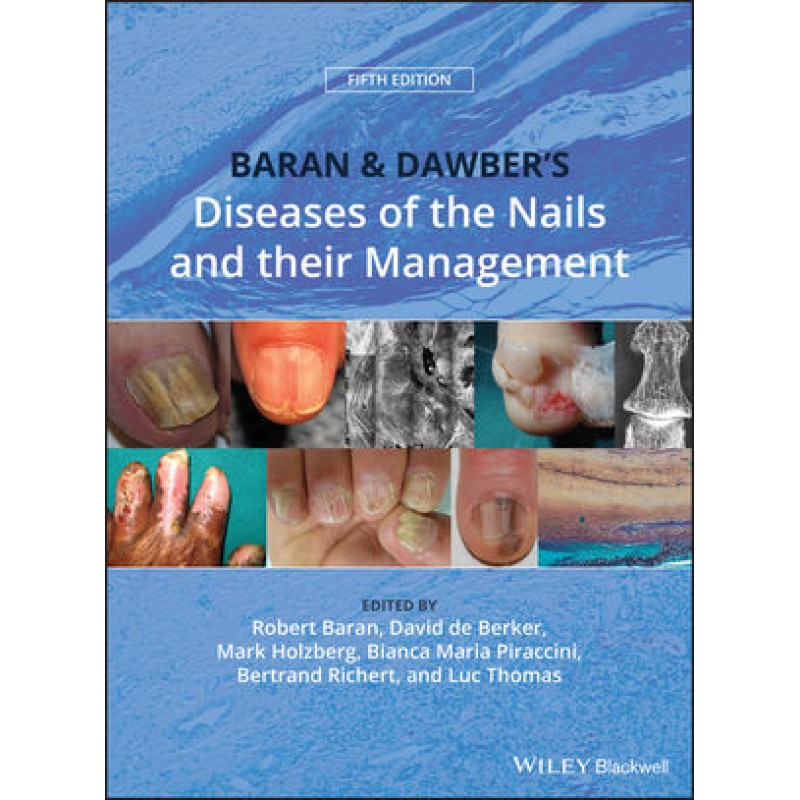 Baran and Dawber's Diseases of the Nails and their Management, 5th Edition