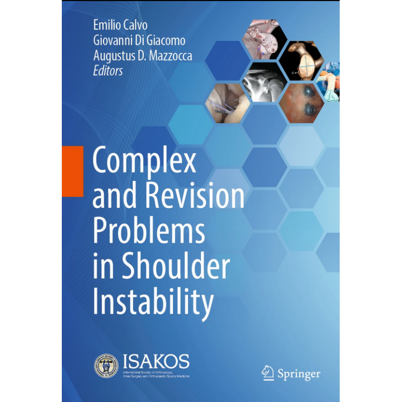 Complex and Revision Problems in Shoulder Instability
