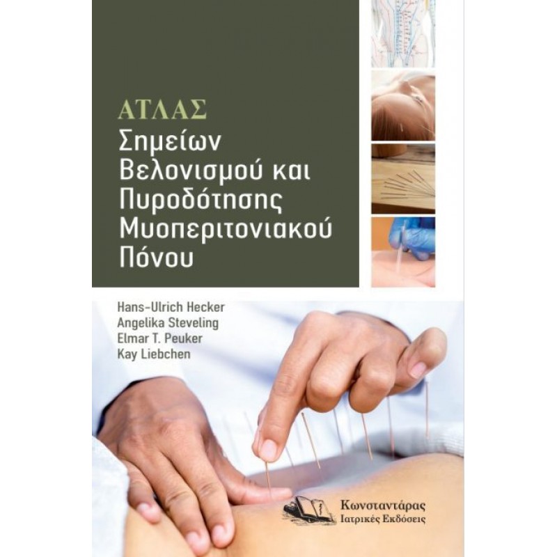 Άτλας Σημείων Βελονισμού και Πυροδότησης Μυοπεριτονιακού Πόνου